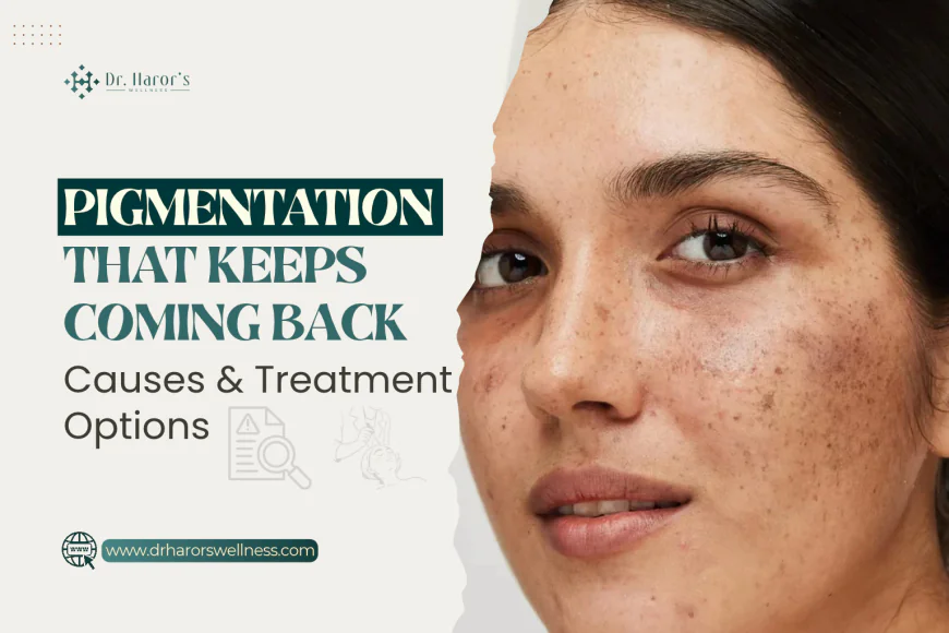 Pigmentation That Keeps Coming Back: Causes & Treatment Options
