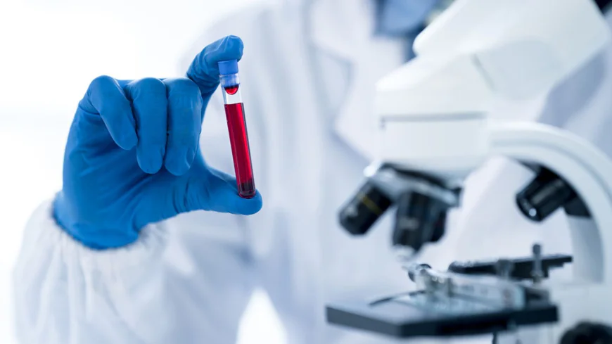 Benefits of Booking a Blood Test At Home