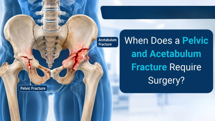 When Does a Pelvic and Acetabulum Fracture Require Surgery?