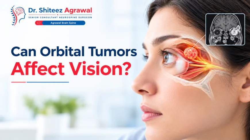 Can Orbital Tumors Affect Vision? Symptoms, Causes, and Treatment Options