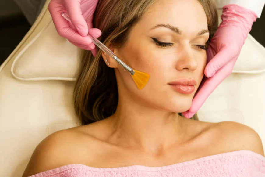 What should you know before choosing Chemical Peels?