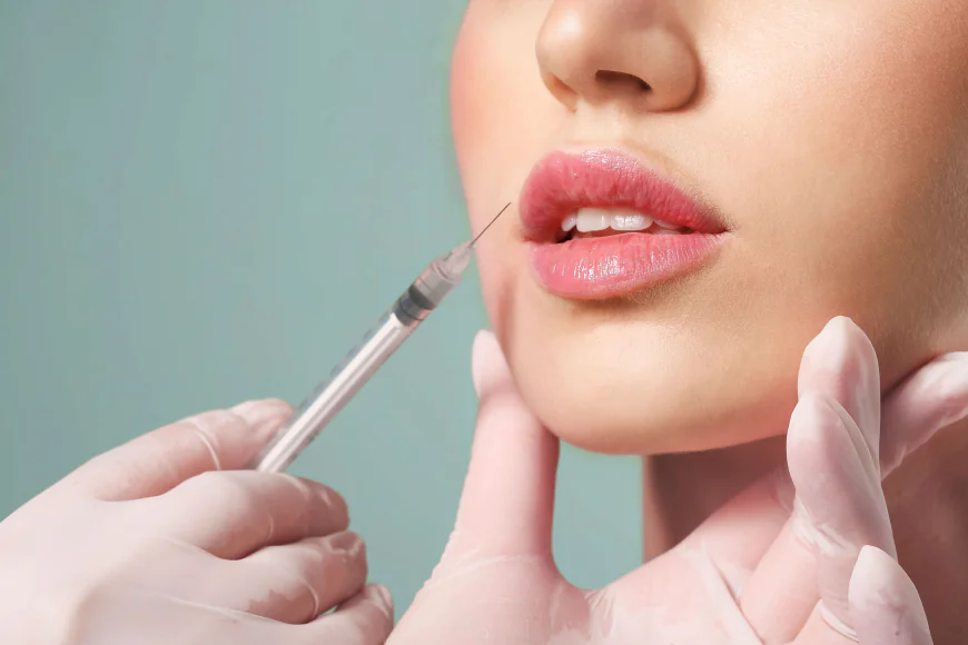 How Can Russian Lip Filler Help Make Lips Look Fuller?