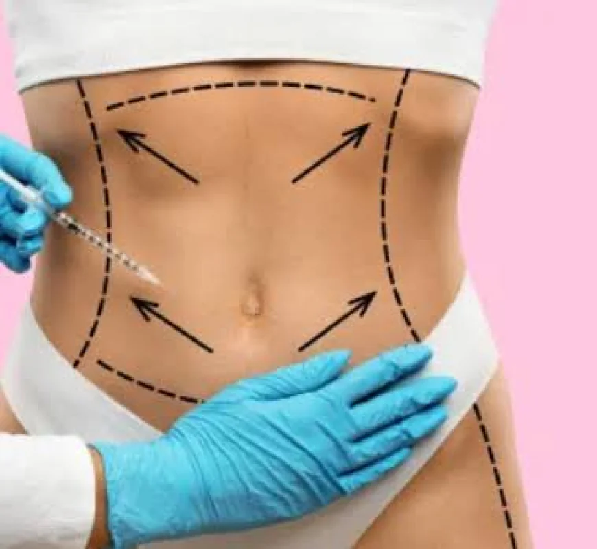 Does Body Fillers treatment help improve body proportions?