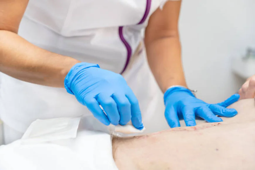 What Can Skin Lesion Removal Treat?