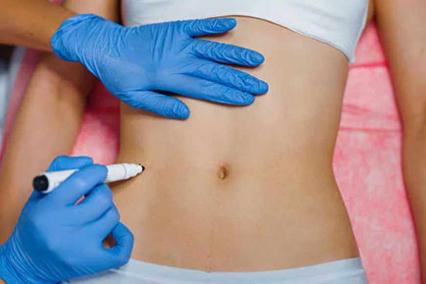 What Can Body Fillers Do for Body Shape?