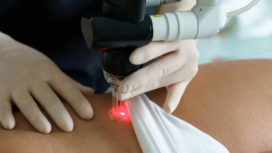 What Factors Affect Scar Laser Removal Results?