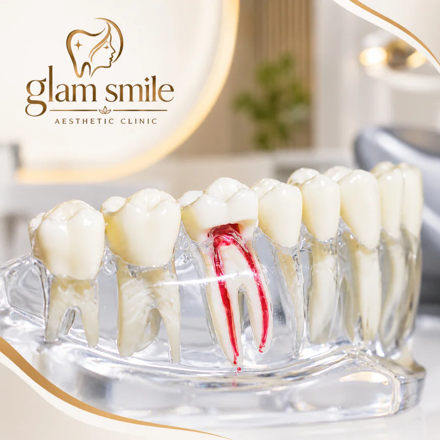 Is It Safe to Delay Root Canal Treatment?