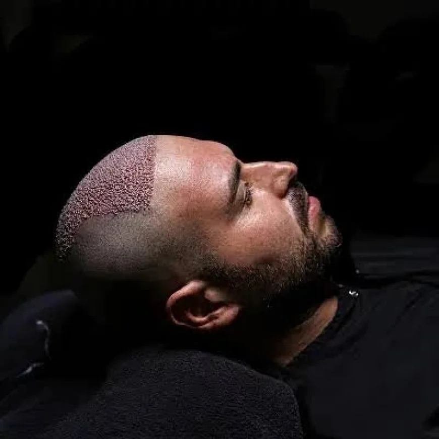 Discover Personalized Hair Growth Solutions with DHI Hair Transplant