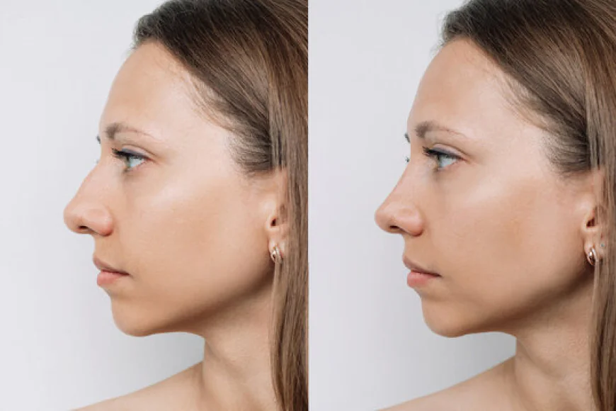 How SKN Cosmetics Can Help Patients Explore Their Nose Surgery Options