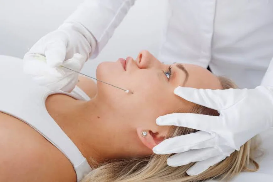 How Does Thread Lift Treatment Lift Loose and Sagging Skin?