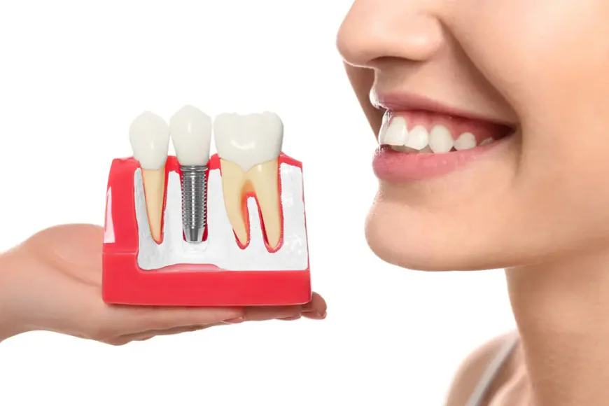 Improve Your Oral Health with Dental Implants in Panacea, FL