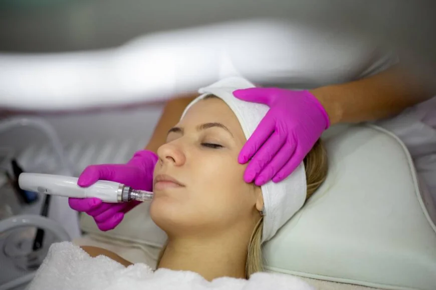 How Can Microneedling Help Revitalize Your Facial Skin?