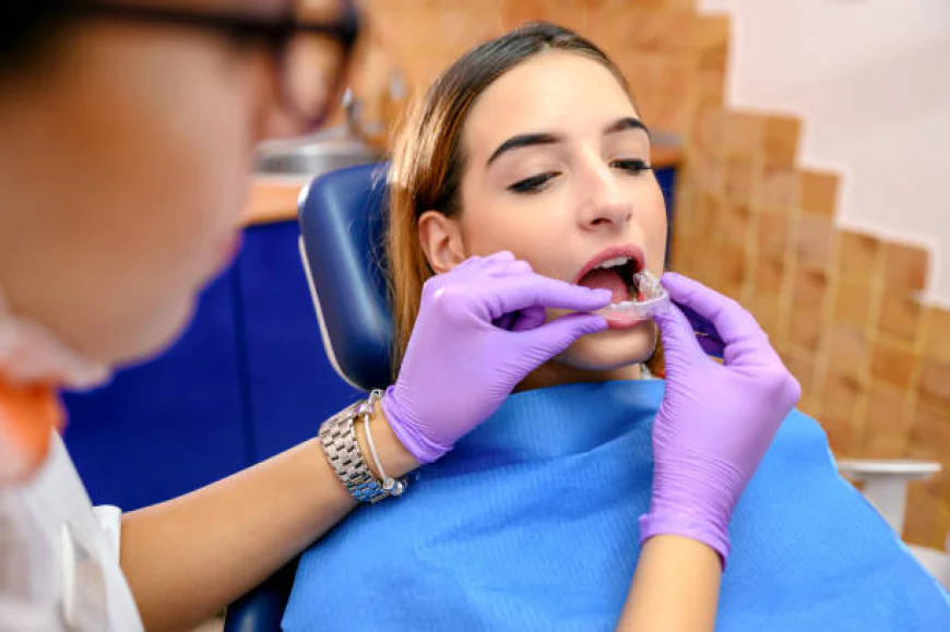 Are Clear Aligners Worth the Cost?