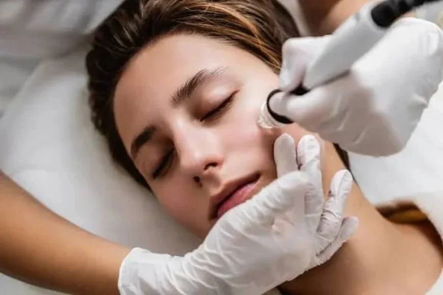 Acne Treatment in Abu Dhabi Find the Right Solution for Your Skin