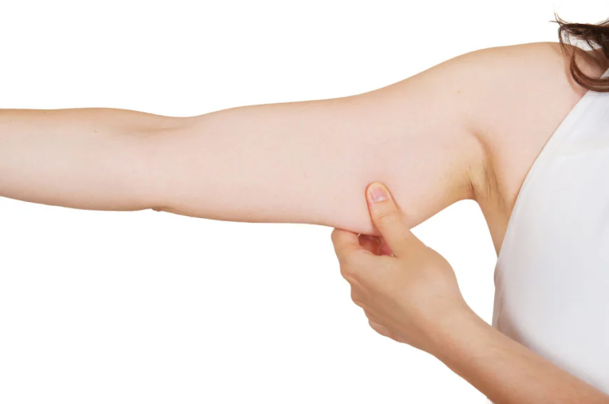 Does Arm Lift Surgery Tighten Loose Skin?