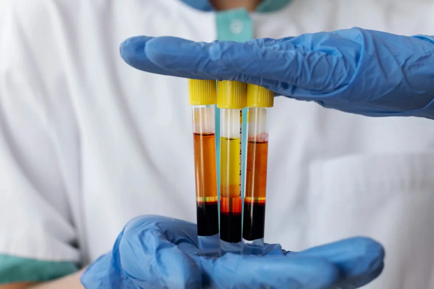 PRP Therapy in Greater Noida