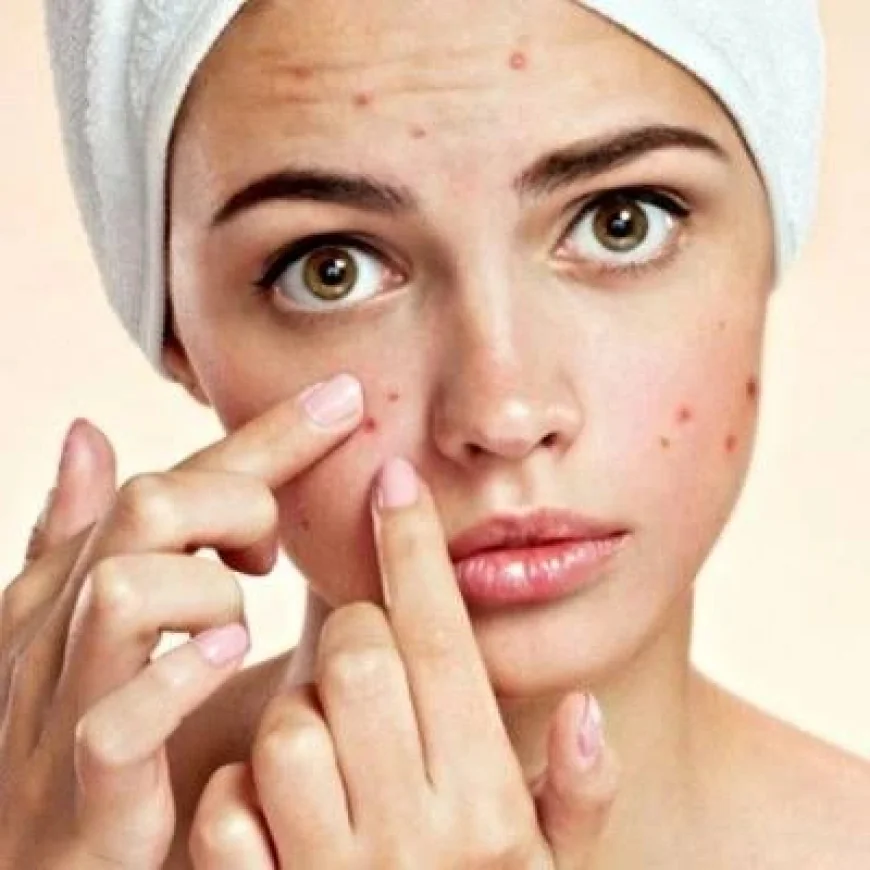 Personalized Skincare Solutions for Acne in Dubai & Sharjah | Glamorous Clinic Dubai