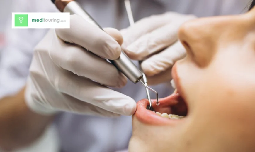 A Complete Guide to All-on-4 Dental Implants Abroad for UK Patients