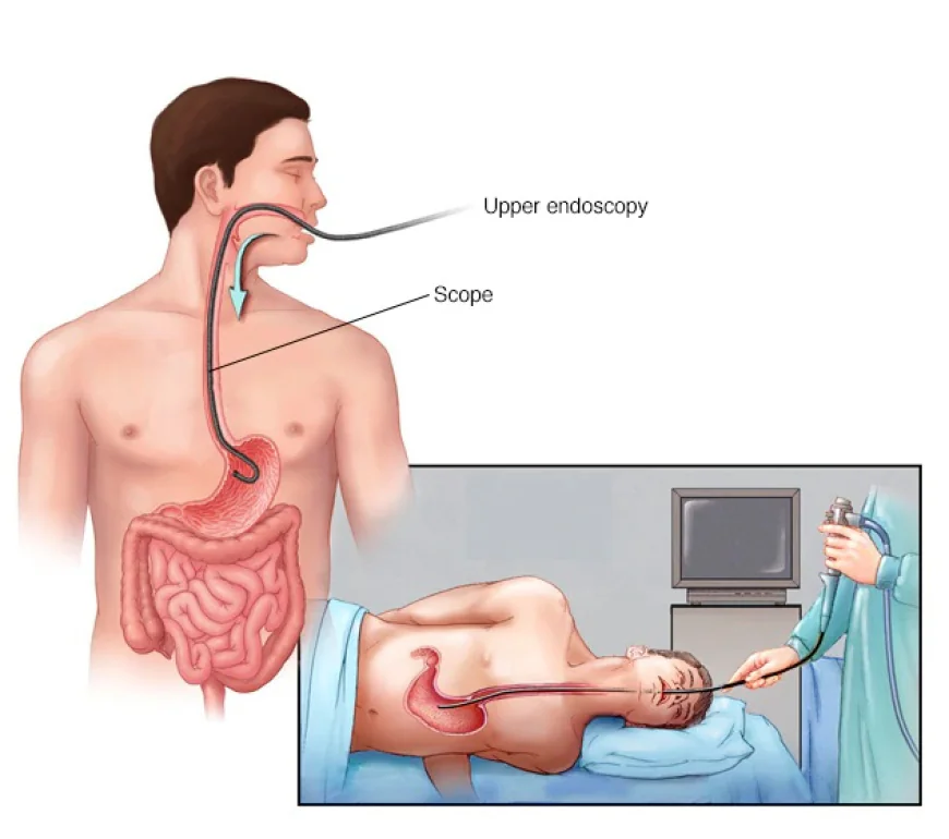 Painless Endoscopy Hospital in Guwahati: Tests and Preparation