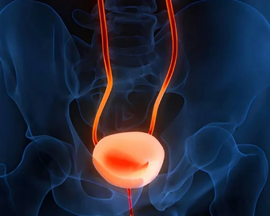 Robotic Radical Cystectomy in Lucknow