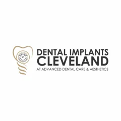 Dental Implants Cleveland